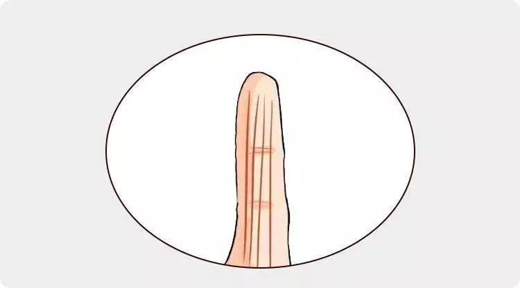 指头关节的皱纹叫什么名字？（指节纹含义）-图3